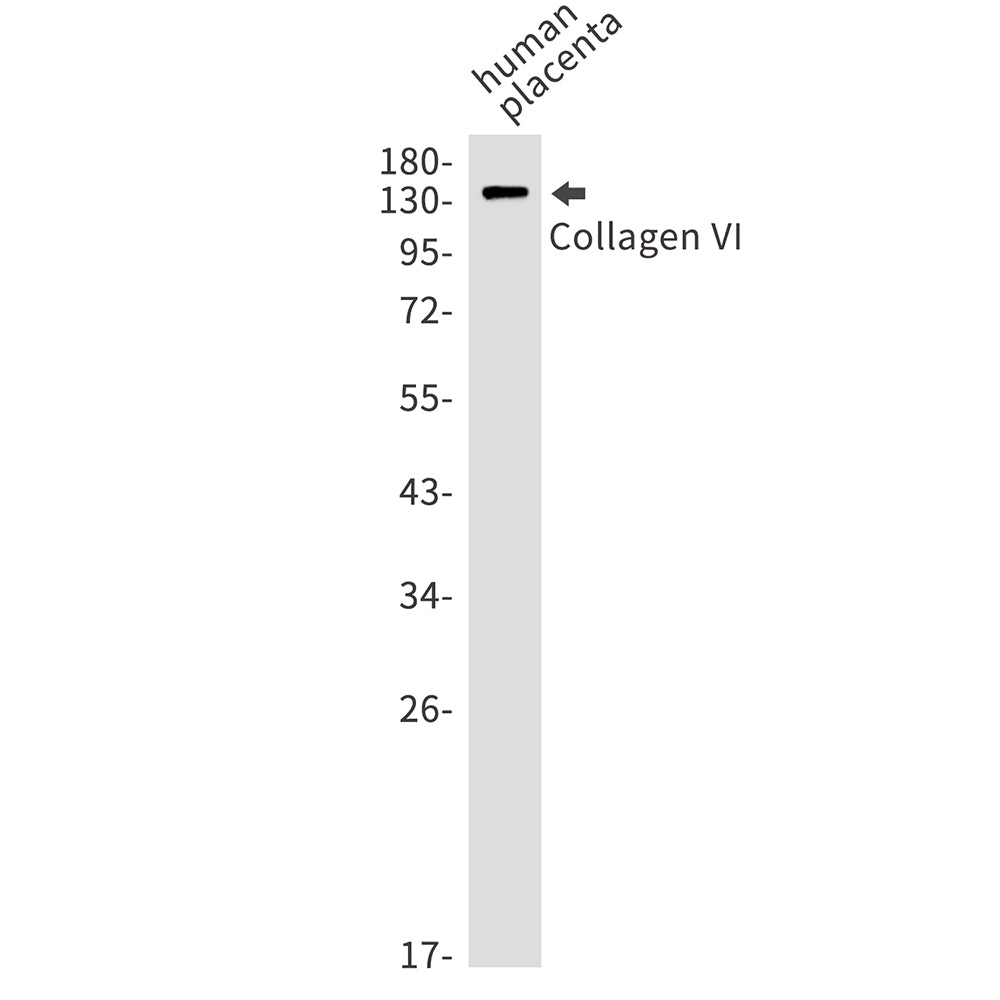 Anti-Collagen VI alpha 1 Rabbit Monoclonal Antibody