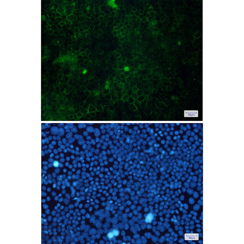 Anti-Cortactin Rabbit Monoclonal Antibody