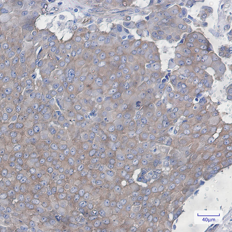 Anti-Cortactin Rabbit Monoclonal Antibody