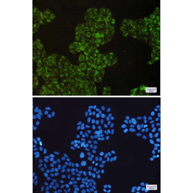Anti-Cyclooxygenase 1 Rabbit Monoclonal Antibody