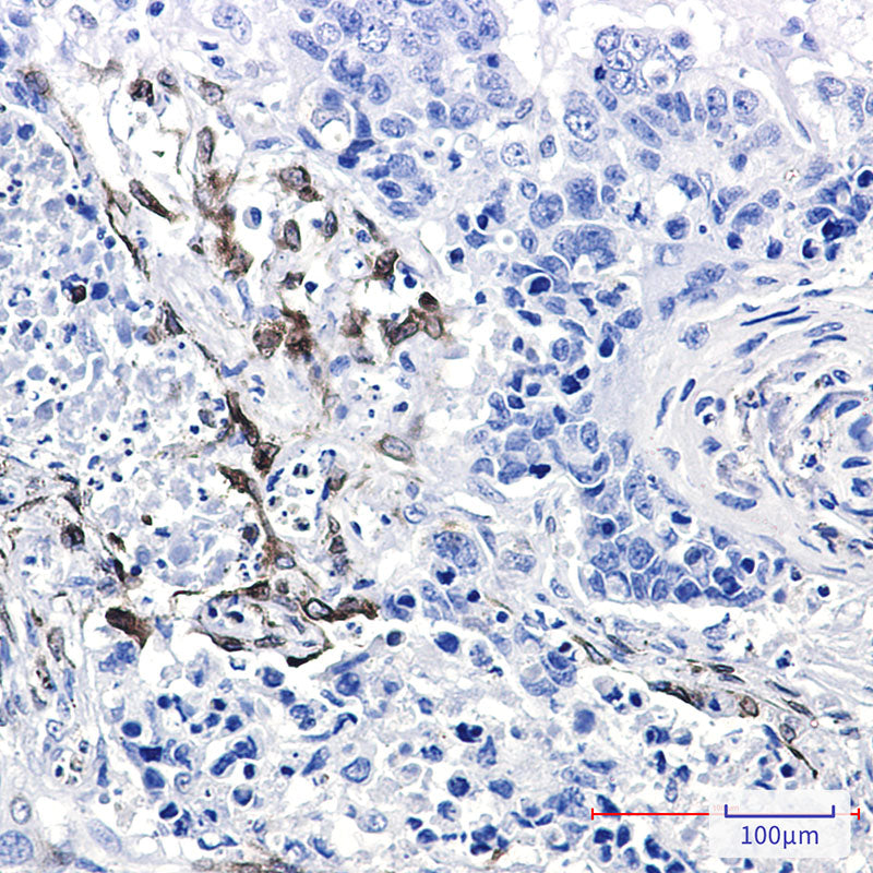 Anti-Cyclooxygenase 2 Rabbit Monoclonal Antibody