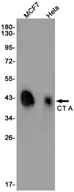 Anti-CT A Rabbit Monoclonal Antibody
