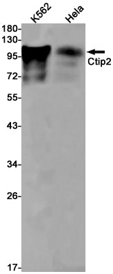 Anti-Ctip2 Rabbit Monoclonal Antibody