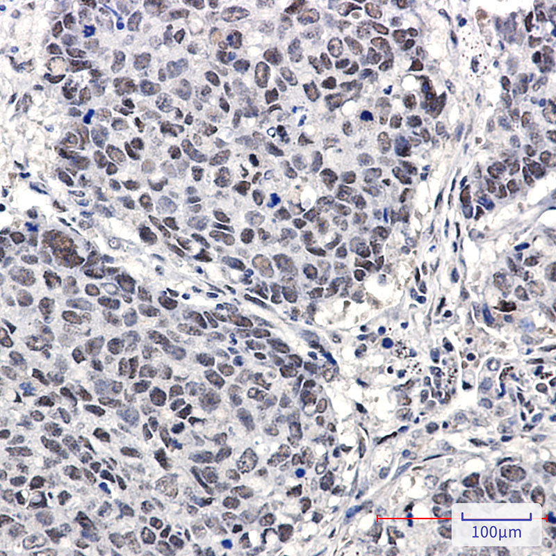 Anti-Cullin 4A/4B Rabbit Monoclonal Antibody