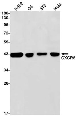 Anti-CXCR5 Rabbit Monoclonal Antibody
