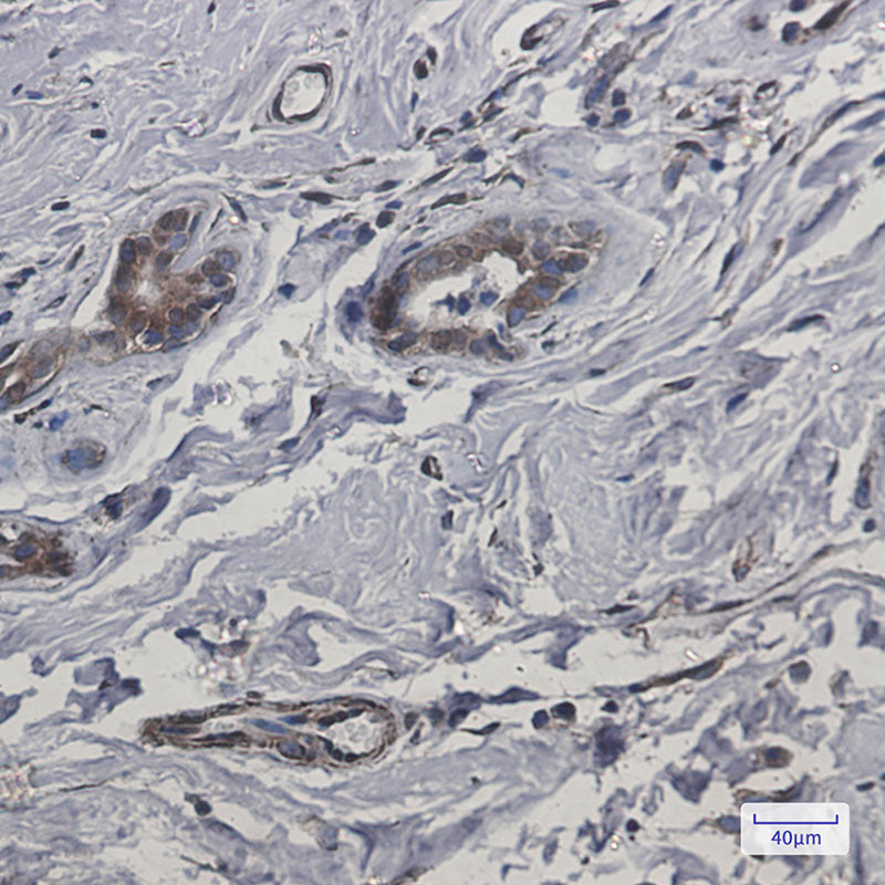 Anti-CYB5R3 Rabbit Monoclonal Antibody