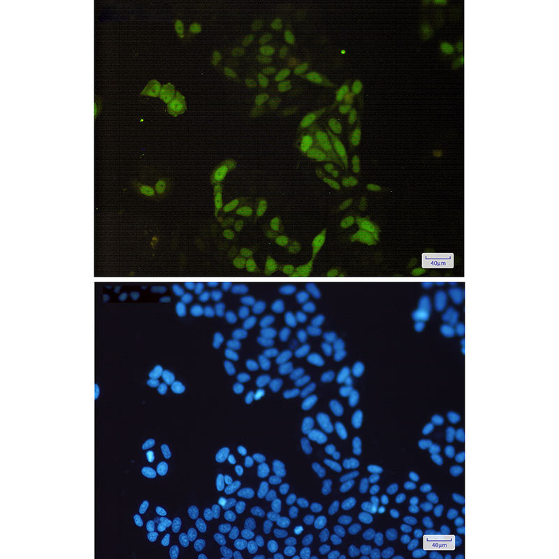 Anti-Cyclin A2 Rabbit Monoclonal Antibody