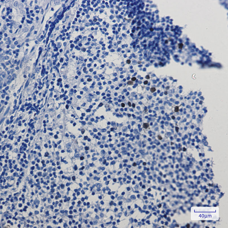 Anti-Cyclin A2 Rabbit Monoclonal Antibody