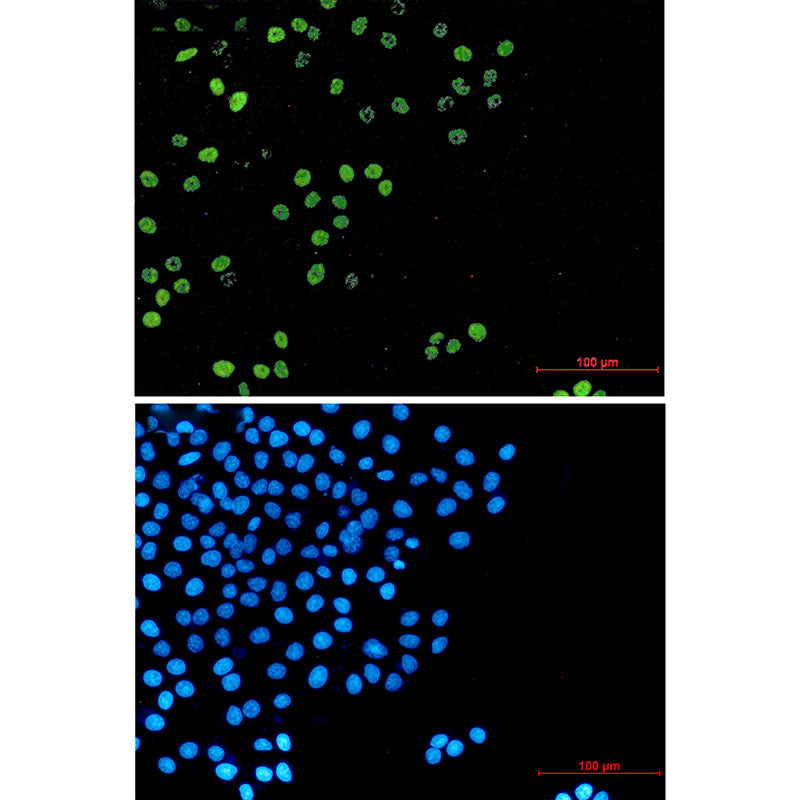 Anti-Cyclin A2 Rabbit Monoclonal Antibody