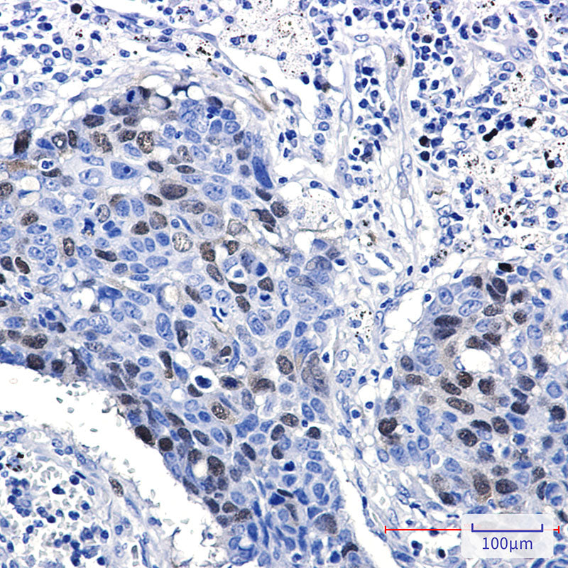 Anti-Cyclin A2 Rabbit Monoclonal Antibody