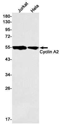 Anti-Cyclin A2 Rabbit Monoclonal Antibody