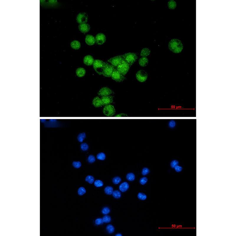 Anti-Cyclin E2 Rabbit Monoclonal Antibody