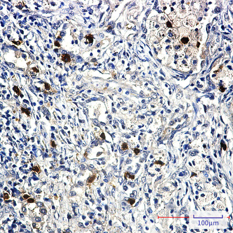Anti-Cyclin E2 Rabbit Monoclonal Antibody