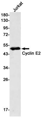 Anti-Cyclin E2 Rabbit Monoclonal Antibody