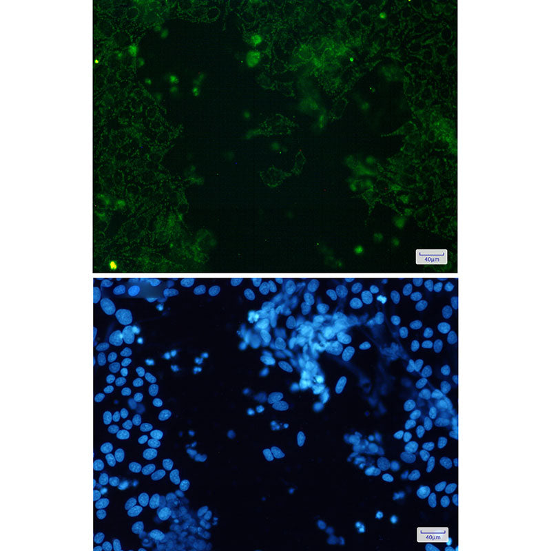 Anti-Cytochrome P450 17A1 Rabbit Monoclonal Antibody