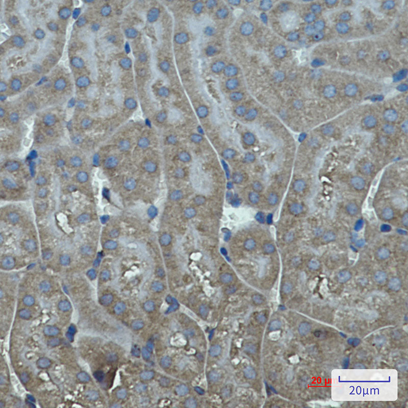 Anti-Cytochrome P450 17A1 Rabbit Monoclonal Antibody
