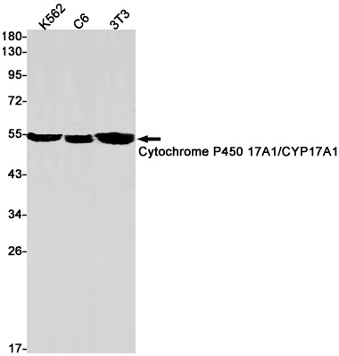 Anti-Cytochrome P450 17A1 Rabbit Monoclonal Antibody