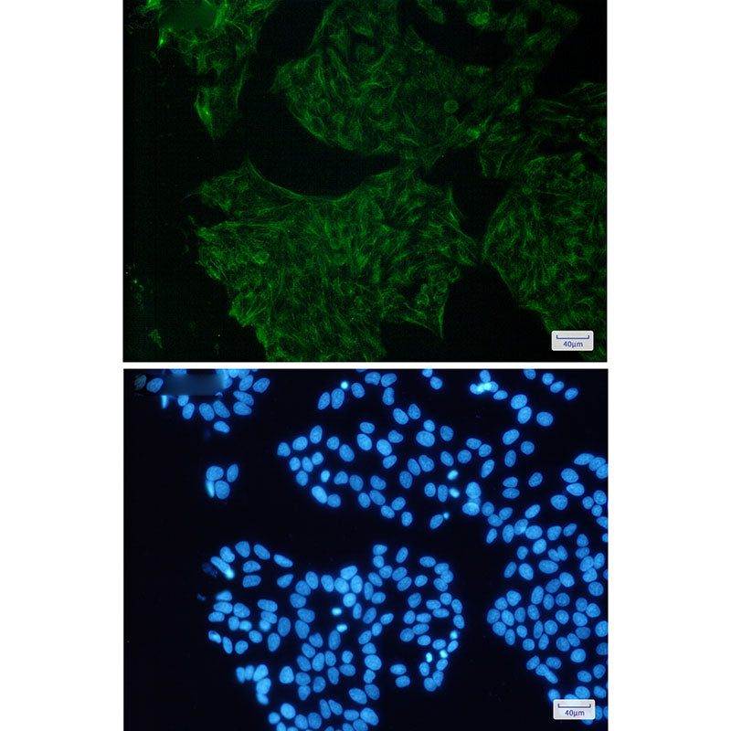 Anti-Cytokeratin 18 Rabbit Monoclonal Antibody