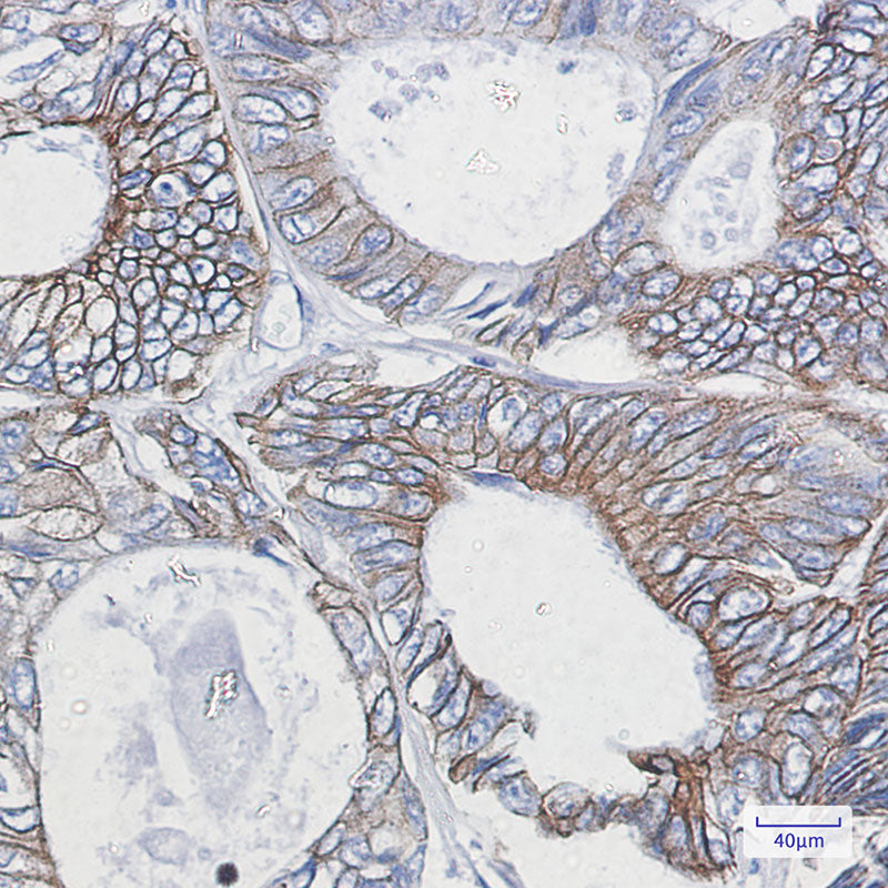 Anti-Cytokeratin 18 Rabbit Monoclonal Antibody