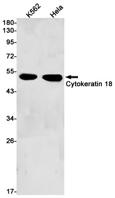 Anti-Cytokeratin 18 Rabbit Monoclonal Antibody