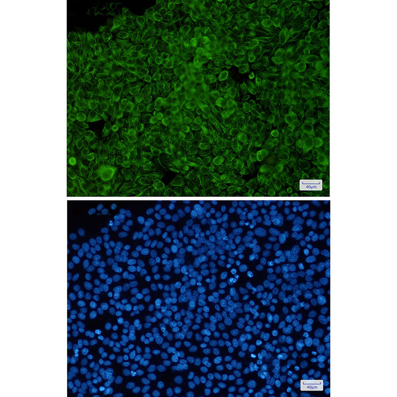 Anti-Phospho-Cytokeratin 8 (Ser23) Rabbit Monoclonal Antibody