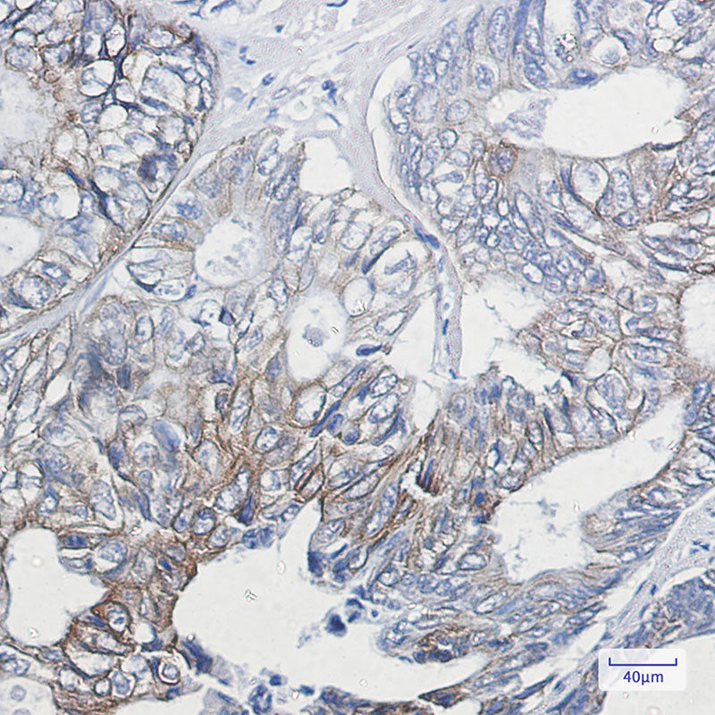 Anti-Phospho-Cytokeratin 8 (Ser23) Rabbit Monoclonal Antibody