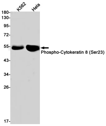 Anti-Phospho-Cytokeratin 8 (Ser23) Rabbit Monoclonal Antibody