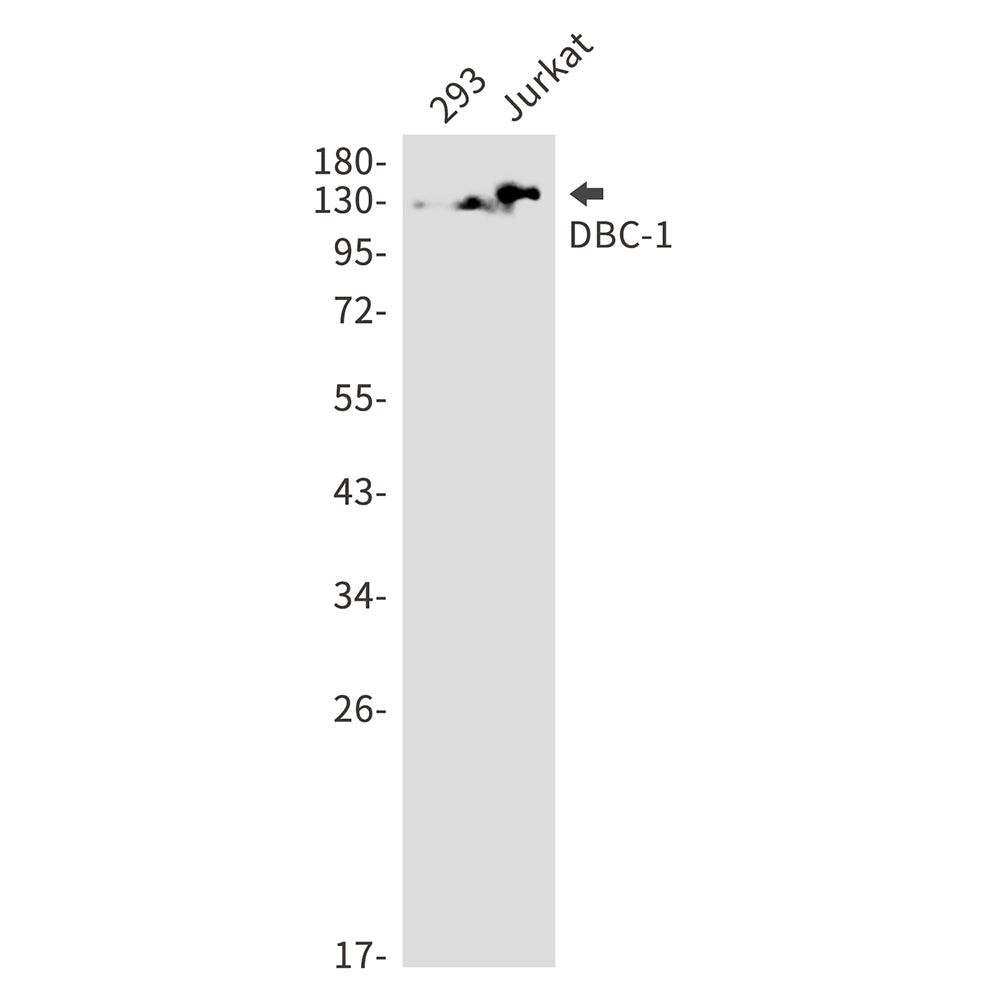 Anti-DBC 1 Rabbit Monoclonal Antibody