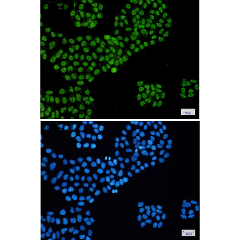 Anti-DDX5 Rabbit Monoclonal Antibody