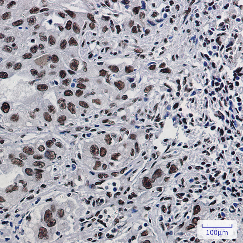 Anti-DDX5 Rabbit Monoclonal Antibody