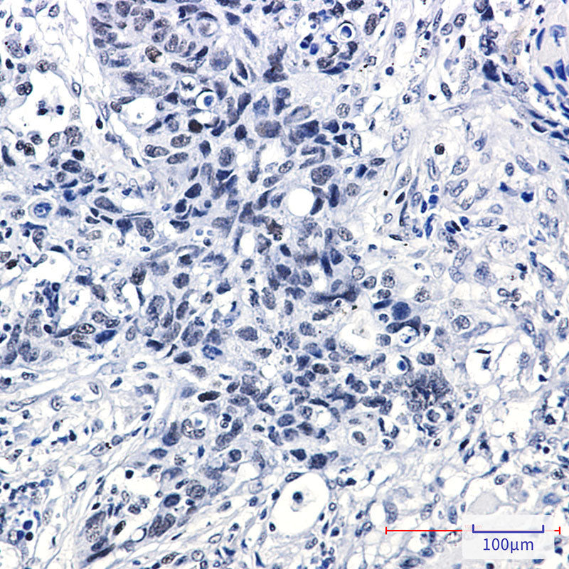 Anti-DEK Rabbit Monoclonal Antibody