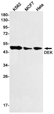 Anti-DEK Rabbit Monoclonal Antibody