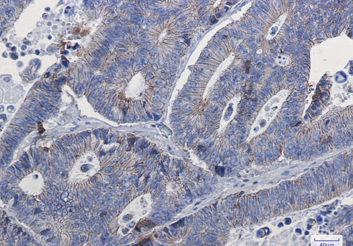 Anti-delta 1 Catenin Rabbit Monoclonal Antibody