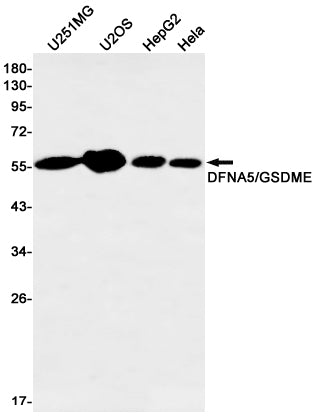Anti-GSDME Rabbit Monoclonal Antibody