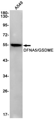 Anti-GSDME Rabbit Monoclonal Antibody