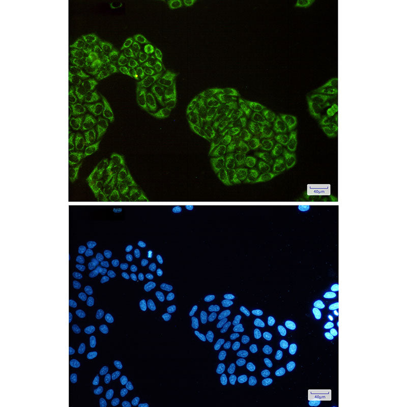 Anti-DISC1 Rabbit Monoclonal Antibody