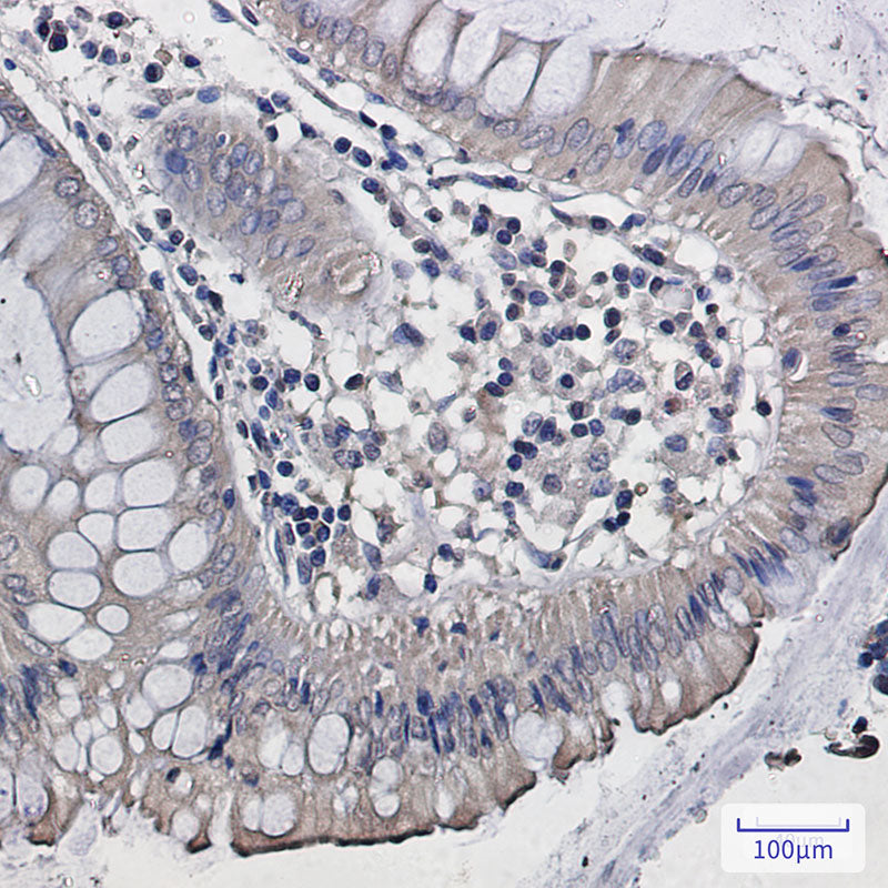Anti-DISC1 Rabbit Monoclonal Antibody