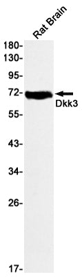 Anti-DKK3 Rabbit Monoclonal Antibody
