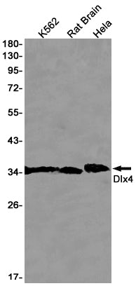 Anti-DLX4 Rabbit Monoclonal Antibody