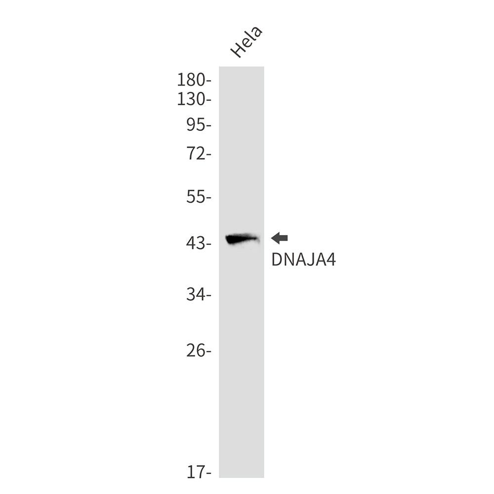 Anti-DNAJA4 Rabbit Monoclonal Antibody