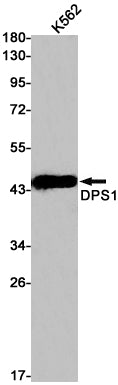 Anti-DPS1 Rabbit Monoclonal Antibody