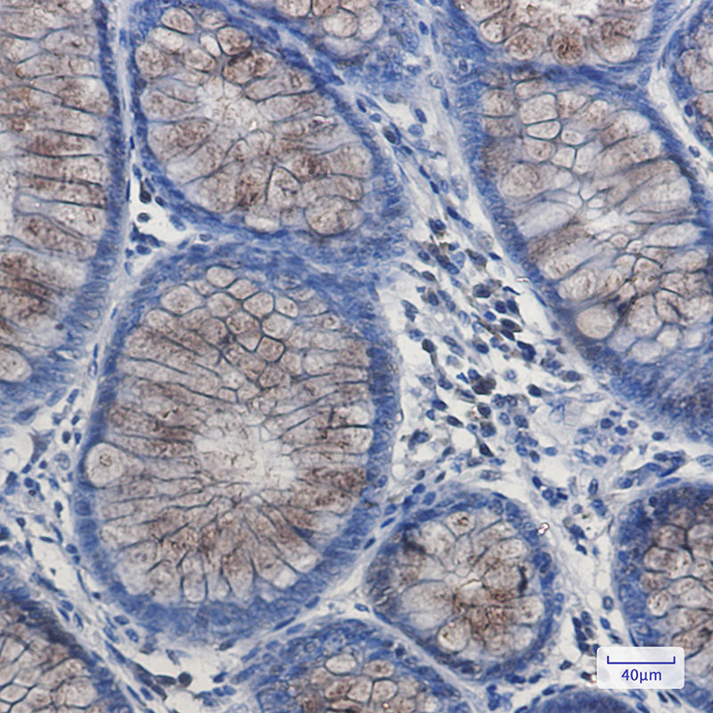 Anti-DYNLL1 Rabbit Monoclonal Antibody