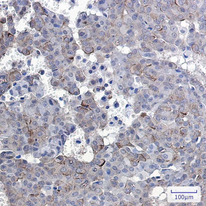 Anti-Phospho-EGFR (Tyr1092) Rabbit Monoclonal Antibody