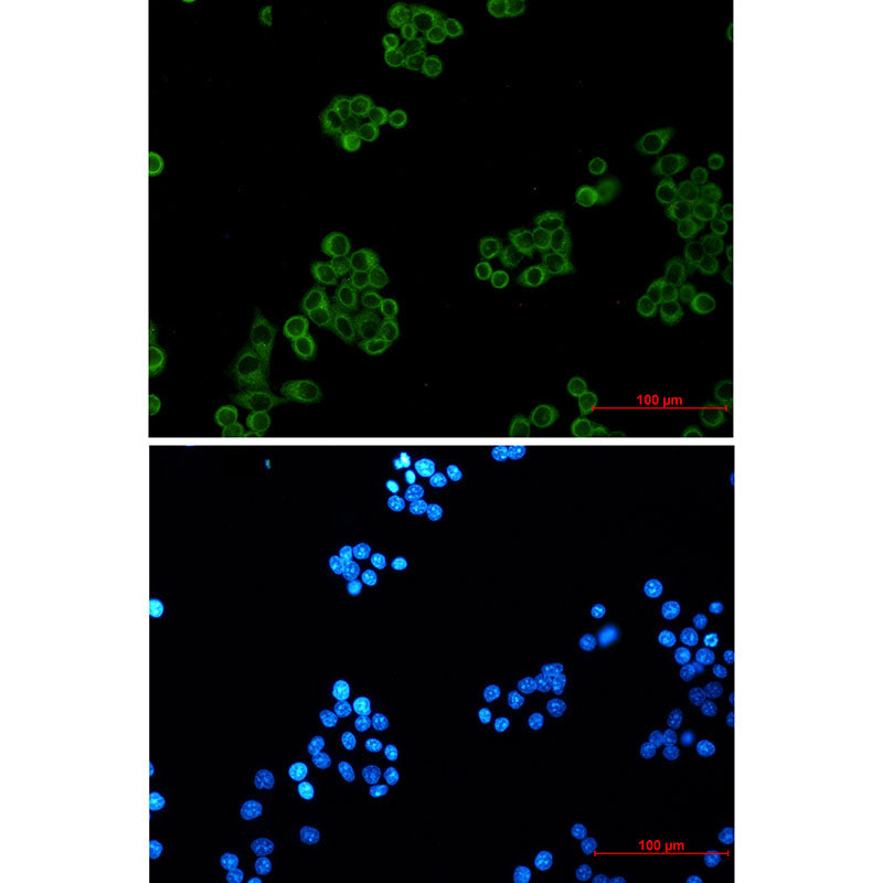 Anti-EHD1 Rabbit Monoclonal Antibody