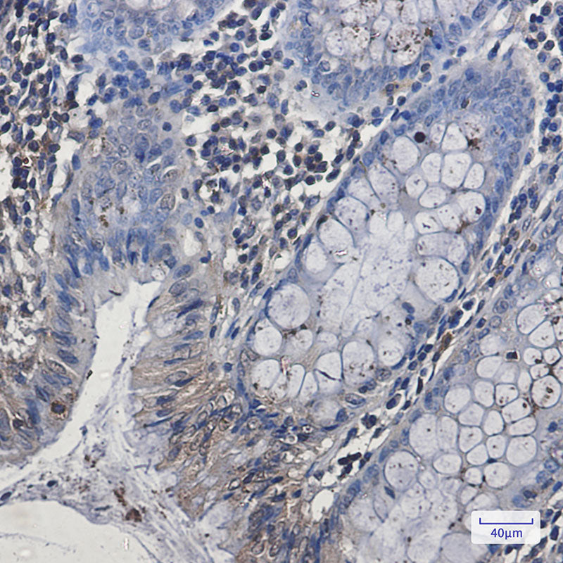 Anti-EHD1 Rabbit Monoclonal Antibody