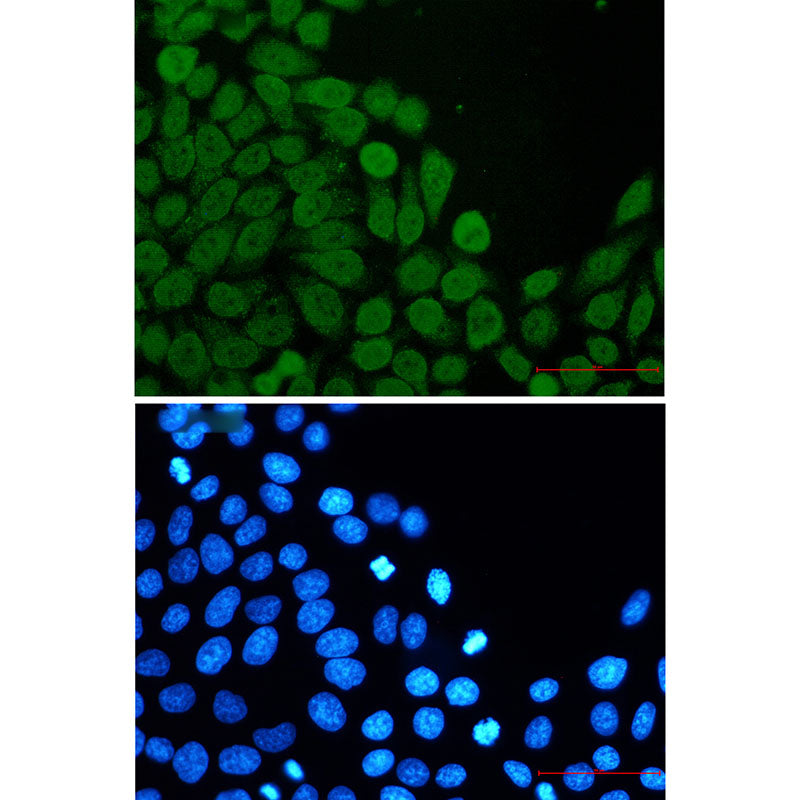 Anti-eIF4A3 Rabbit Monoclonal Antibody