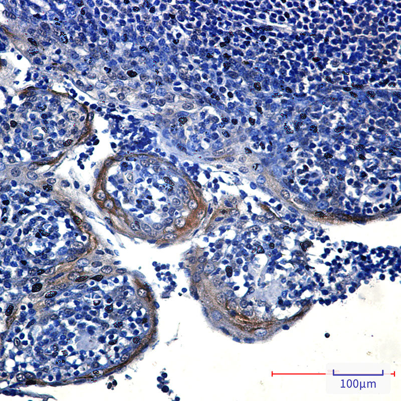 Anti-eIF4A3 Rabbit Monoclonal Antibody