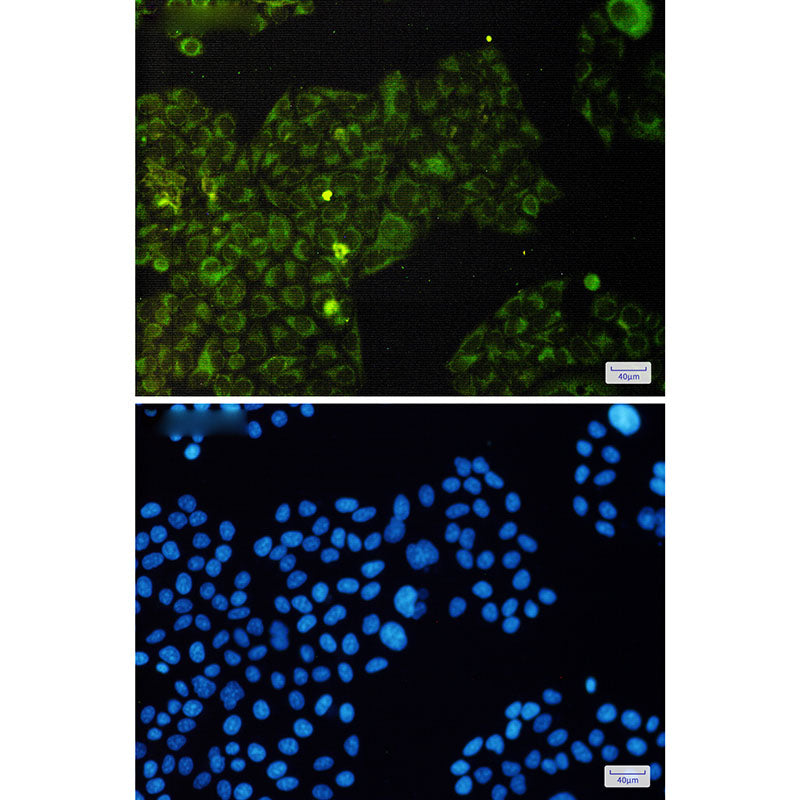 Anti-Phospho-eIF4E (Ser209) Rabbit Monoclonal Antibody