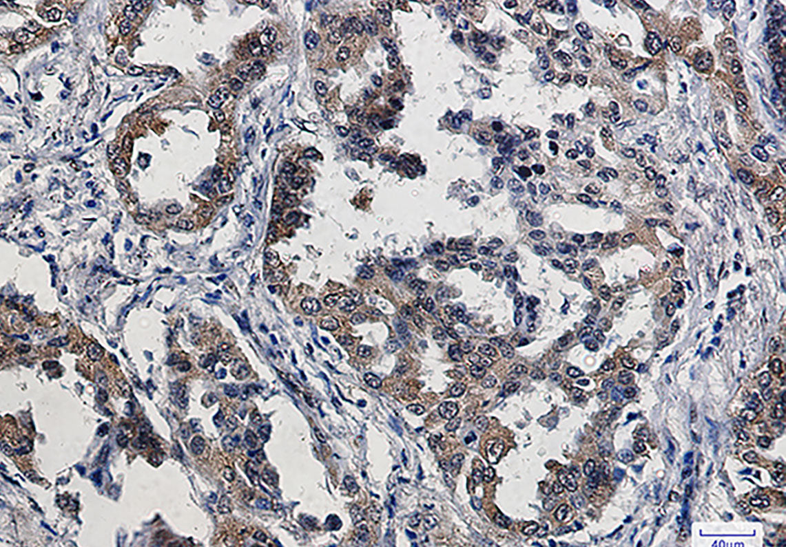 Anti-Phospho-eIF4E (Ser209) Rabbit Monoclonal Antibody