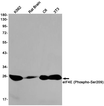 Anti-Phospho-eIF4E (Ser209) Rabbit Monoclonal Antibody